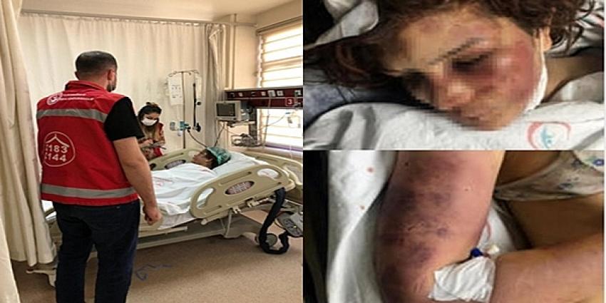 Bakanlık Şiddet Gören Kadına Sahip Çıktı (Video)Güncellendi