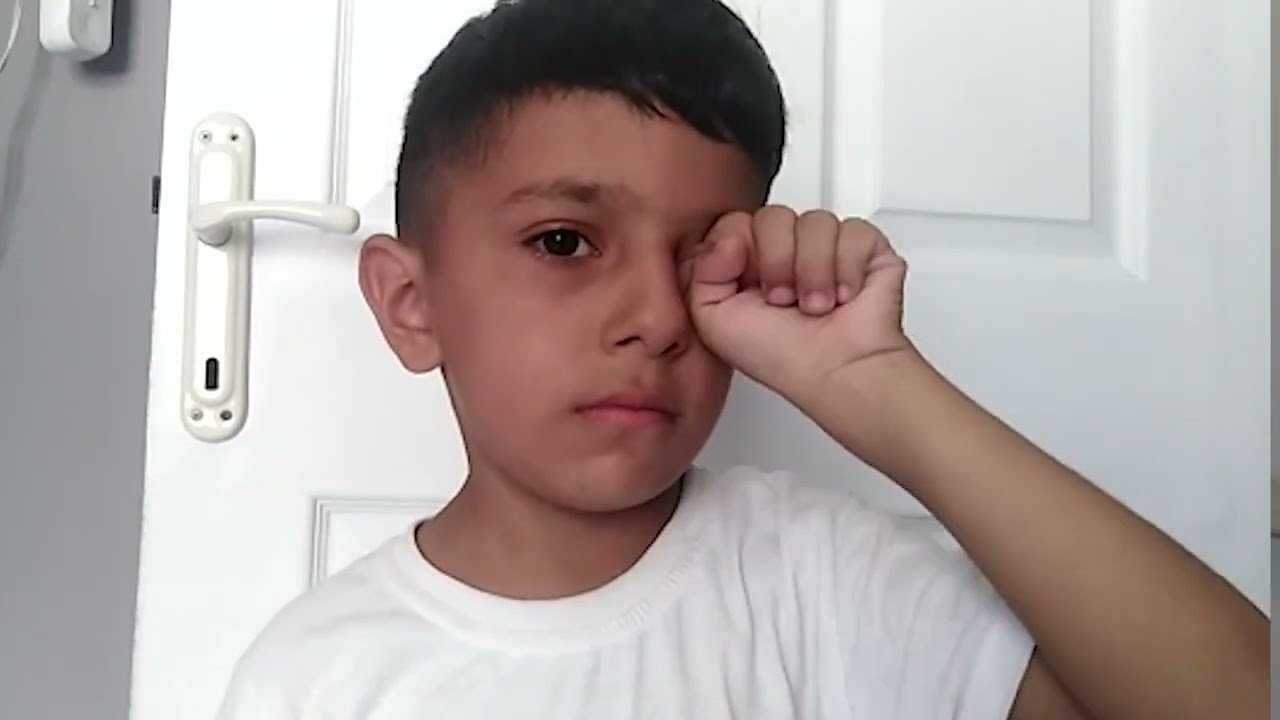 Dikkat! gözdeki her kızarıklık alerji belirtisi olmayabiliyor