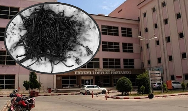 Zihinsel Engelli Bireyin Midesinden Çivi ve Toka Çıktı!