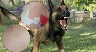 Şanlıurfa Viranşehir’de 6 Yaşındaki Kıza Köpek Saldırısı!
