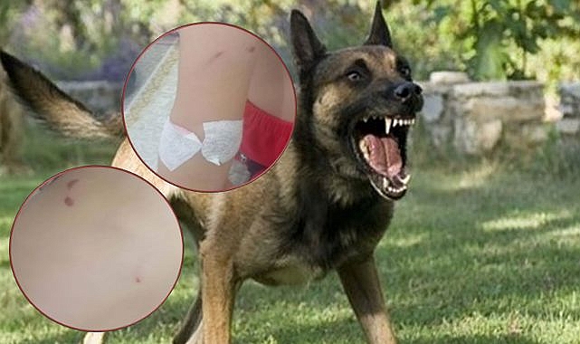 Şanlıurfa Viranşehir’de 6 Yaşındaki Kıza Köpek Saldırısı!